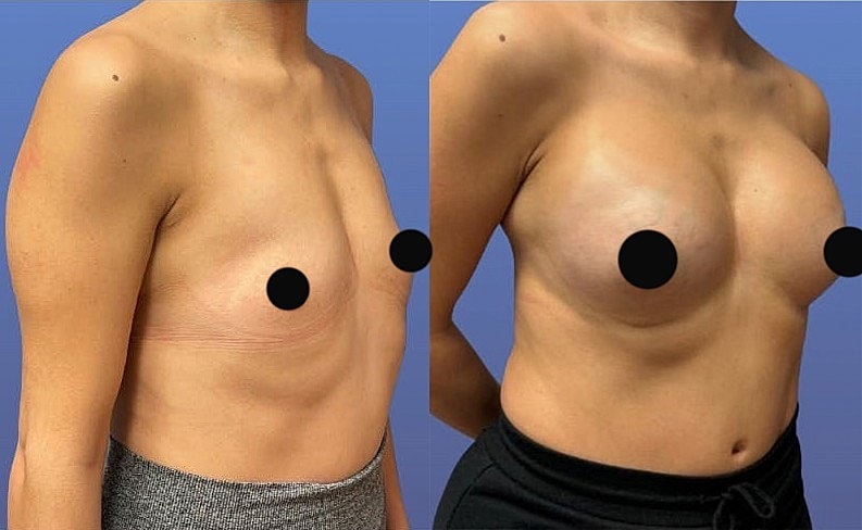 Before and after body image comparison.